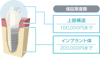 当院とガイドデントによる10年保証