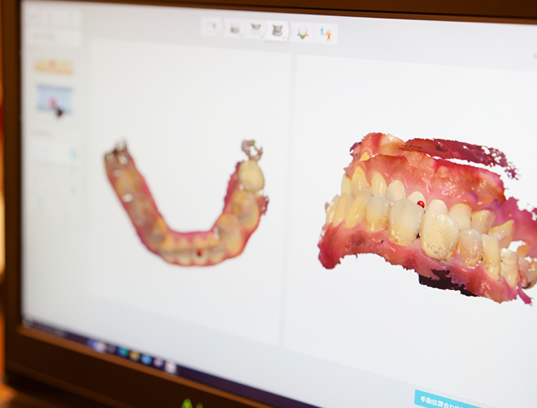 スキャンサンプル
