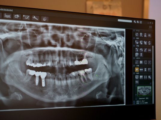 常に最新の治療方法