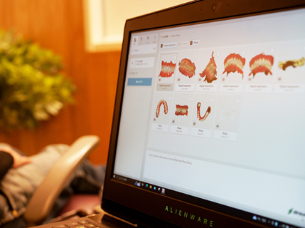 口腔内スキャナーを用いたインプラント治療