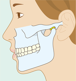 Step2 CTの結果をもとに問題点の把握