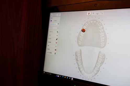 Step1 最初に以下の口腔内の診査・診断を致します。