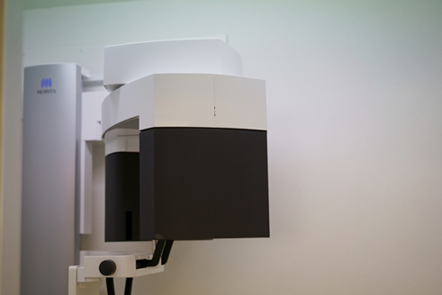 Step2 CTで顎の関節の位置を撮影